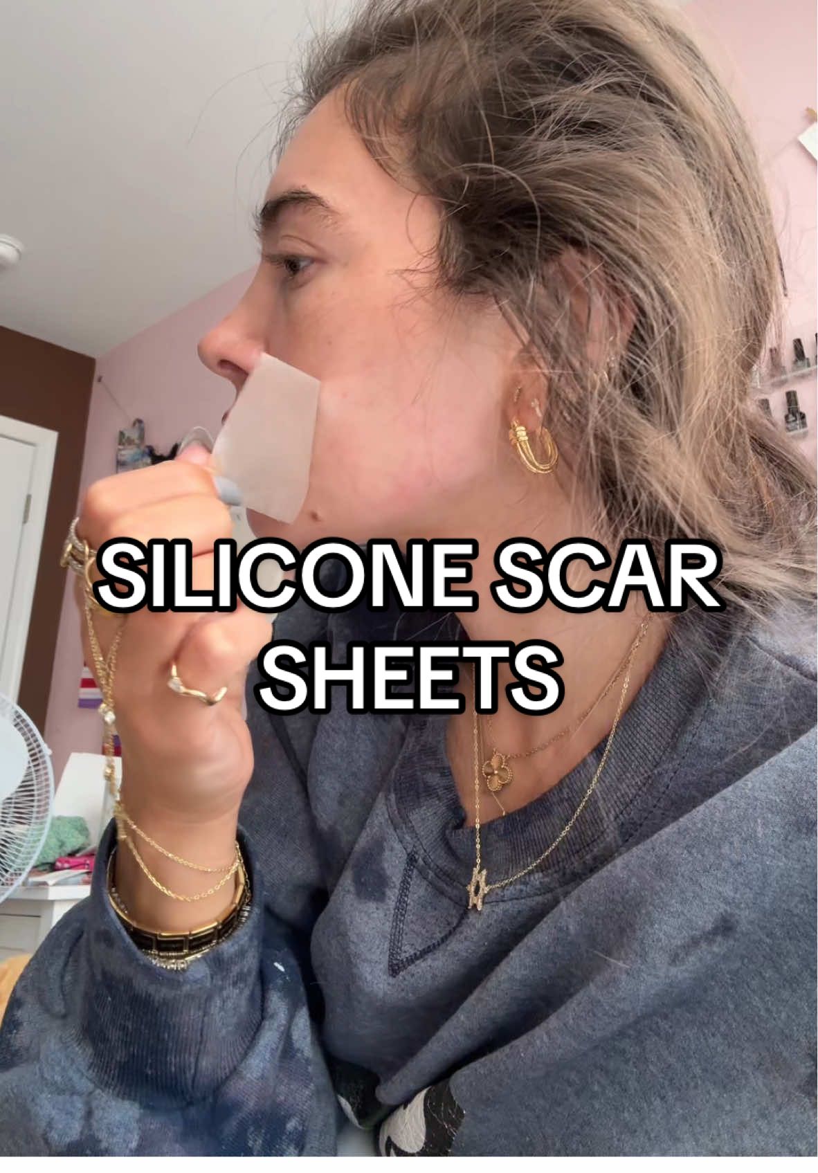 Ft my silicone scar sheets I use on my acne scars lol #sockcurls #scarsheets #silicone #skincare #siliconescarsheets #scars #hair #morningshed 