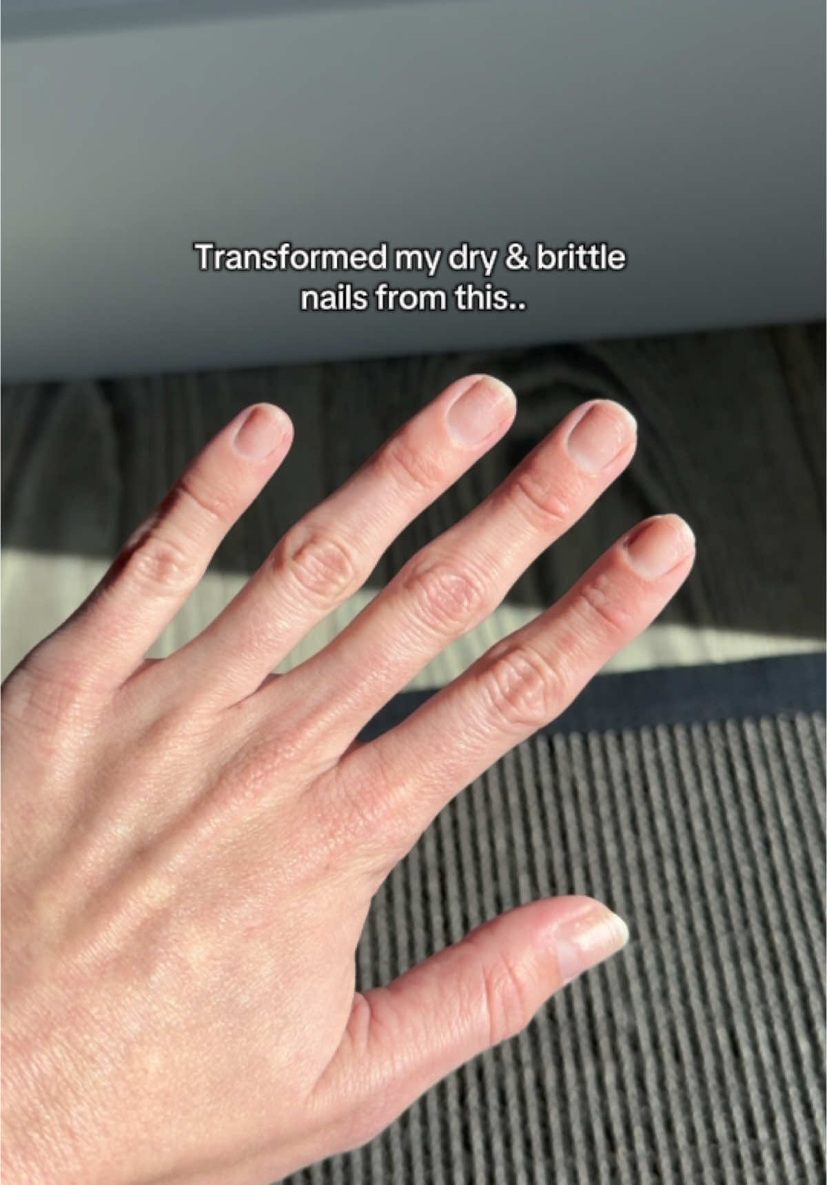 Nails damaged from gels or acrylics? This is the product for you 👀 💅🏻 Our 100% natural nail oil, The Celery Oil, is a game changer for nail strength, overall health and regrowth. #tenoverten #theceleryoil #nailgrowth #nailhealth #longnail #growingnailsout #nailgrowthtips #howtogetlongnails #nailtok 