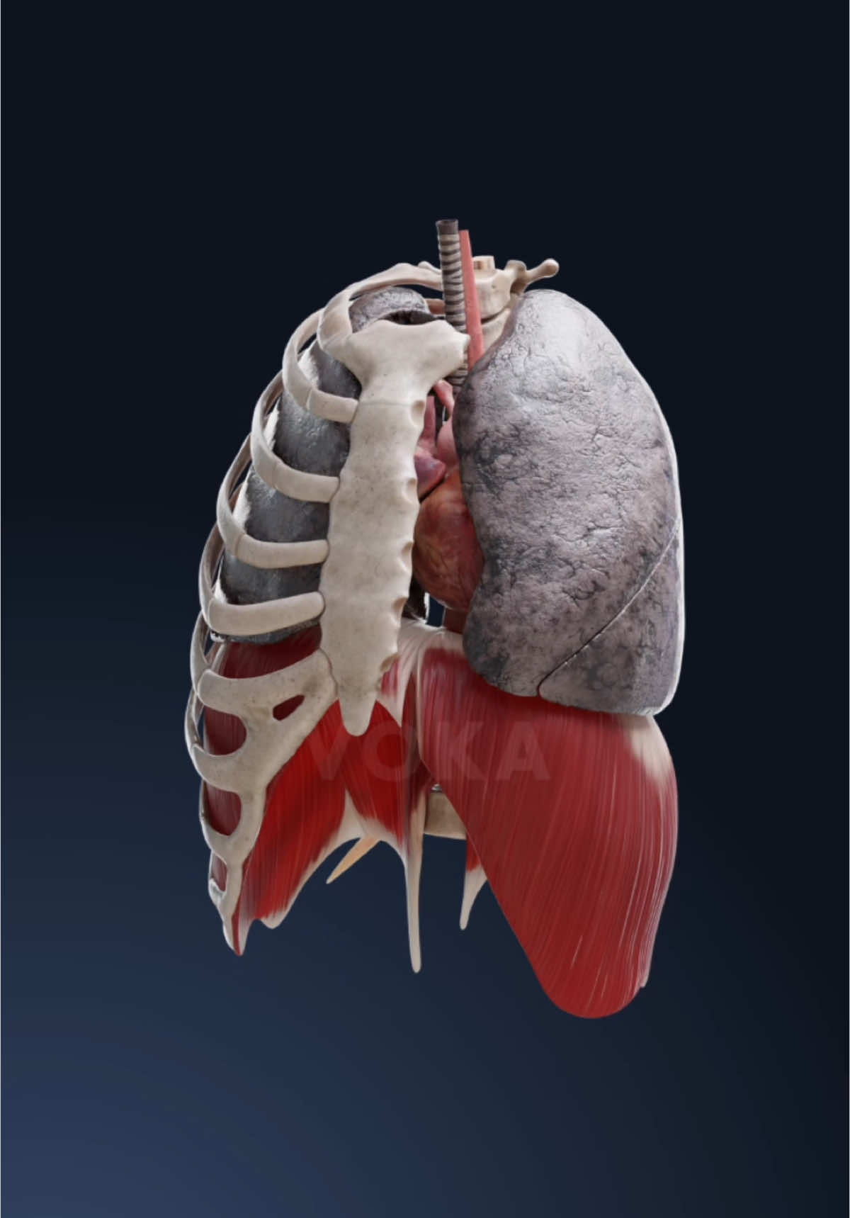 How smoking affects your lungs: a 3D visualization   Watch as tar builds up, causing the lungs to lose elasticity and impeding their ability to effectively exchange oxygen. See how chronic bronchitis and emphysema may develop, leading to wheezing, shortness of breath, and persistent coughing.   Explore the truth about smoker's lungs with VOKA 3D Anatomy & Pathology and see firsthand how smoking harms the body! #lunganatomy #smokingeffects #respiratoryhealth #anatomy #anatomy3d #3danatomy #medstudents #medicalstudents #medicaltsudent #digitallearning #humanbody