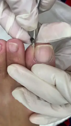 video satisfatório de cutilagem  #unhas #podologa #videosatisfatorio #pedicure #videoviral #explore #viral_video 