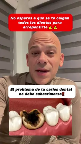 No esperes a que se te caigan todos los dientes para arrepentirte⚠⚠#toothpaste #teethcare #Toothdecay #toothpaste #Hydroxyapatitetoothpaste #Dentalcaries #Fixedteeth #Dentalcare #teeth #tooth #Gingivitis #Oralbacteria #DentalHealth #tiktokshopholidayhaul #FallDealsForYou #tiktokshopblackfriday#msdrwikey 