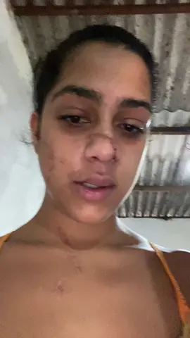 Mostrando Todas cicatrizes que ficaram 