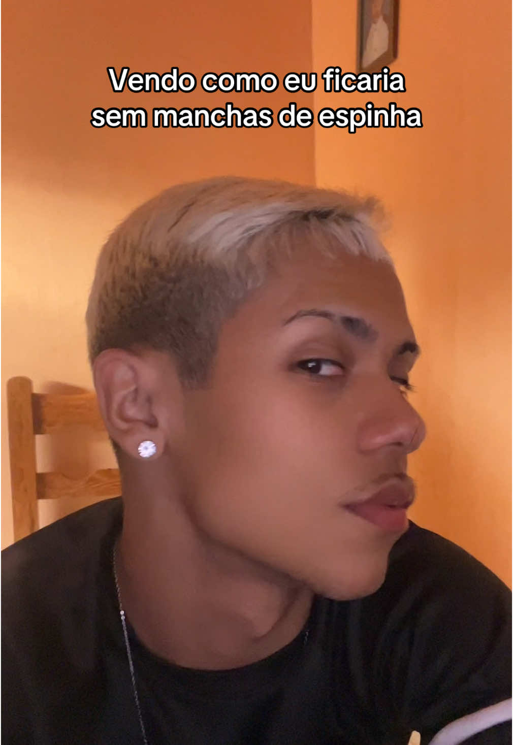 🥲pq eu nao nasci assim#foryou #espinhas #inseguranças 