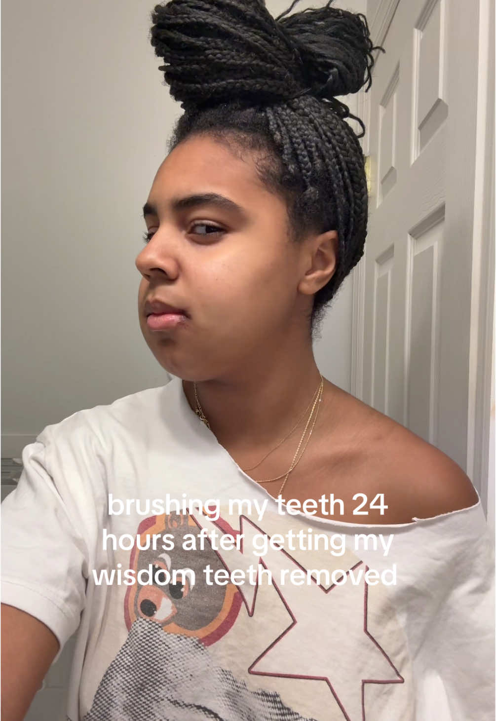 i just want a cheeseburger chat  #wisdomteeth #fyp 