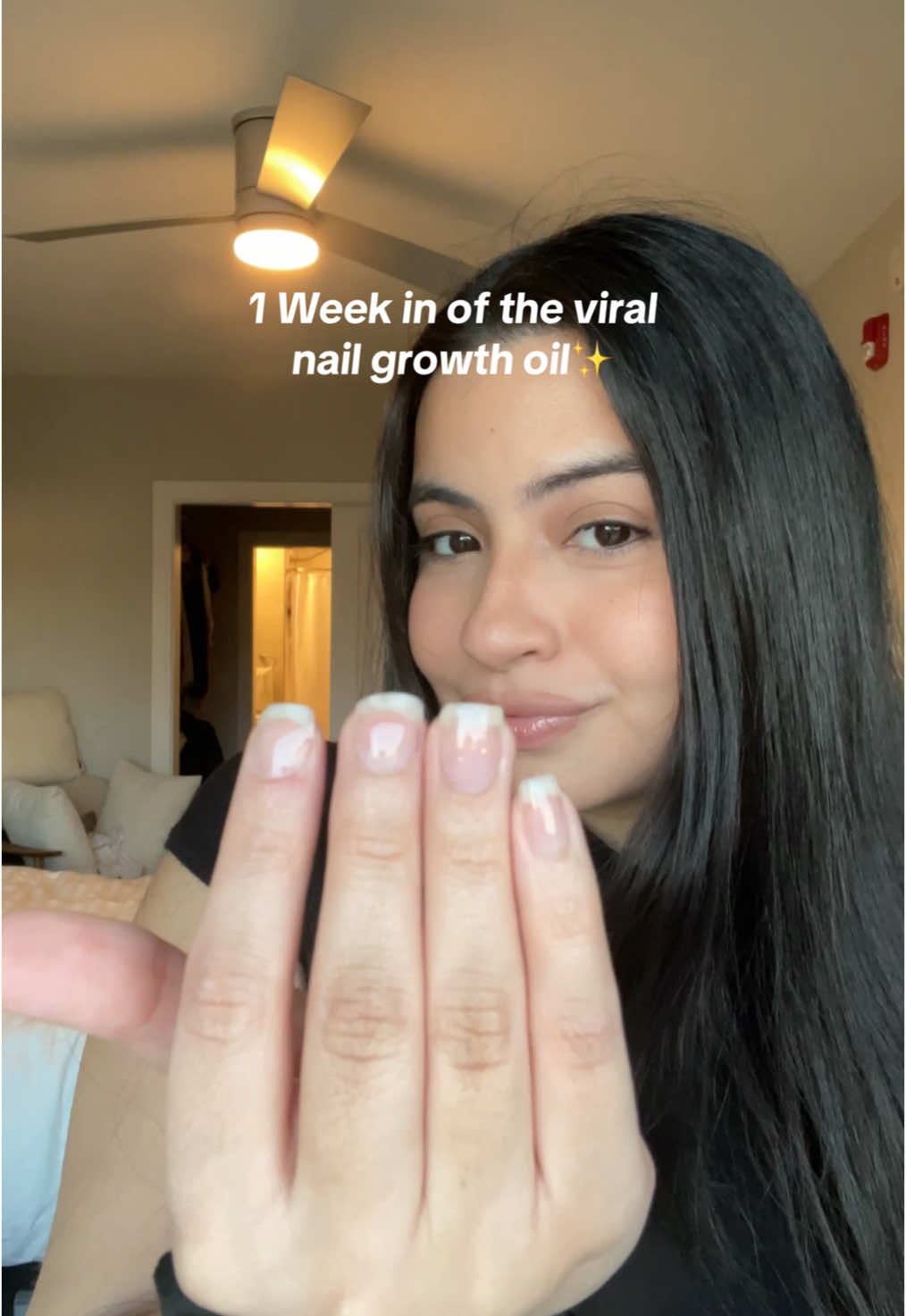ITS WORKING ✨ #nailgrowthoil #nailtok #naturalnails #nailoil #howtogrowyournails  nail growth oil how to grow nails natural