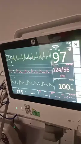 kronik af, kapak hastası  mu, ty, #kalp #damar #kapak #hospital  #hemsire 