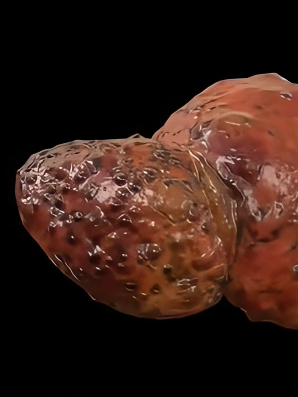 receita americana para limpar o fígado  #gorduranofigadonuncamais #gorduranofígado #Saude #gorduranofigado #saude #gorduranofigadocomoeliminar 