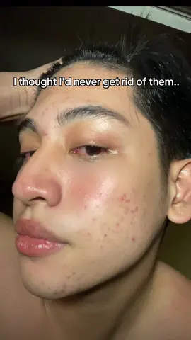 #drleoph #drleo #claymask #clearskin #deepcleansing #porecleansing 