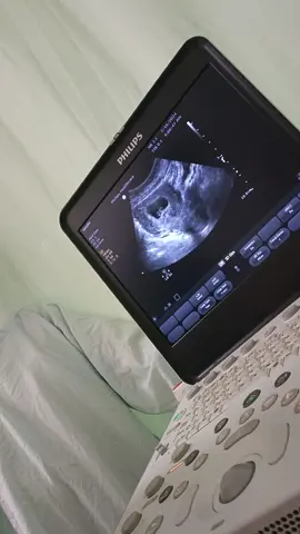 Buang draf dulu waktu USG diRS taiwan usia janin 7minggu 😊#masyaallahtabarakkallah #bumilsehatbayisehat🤰♥️😘😘 #hplmaret2025🤰👶 