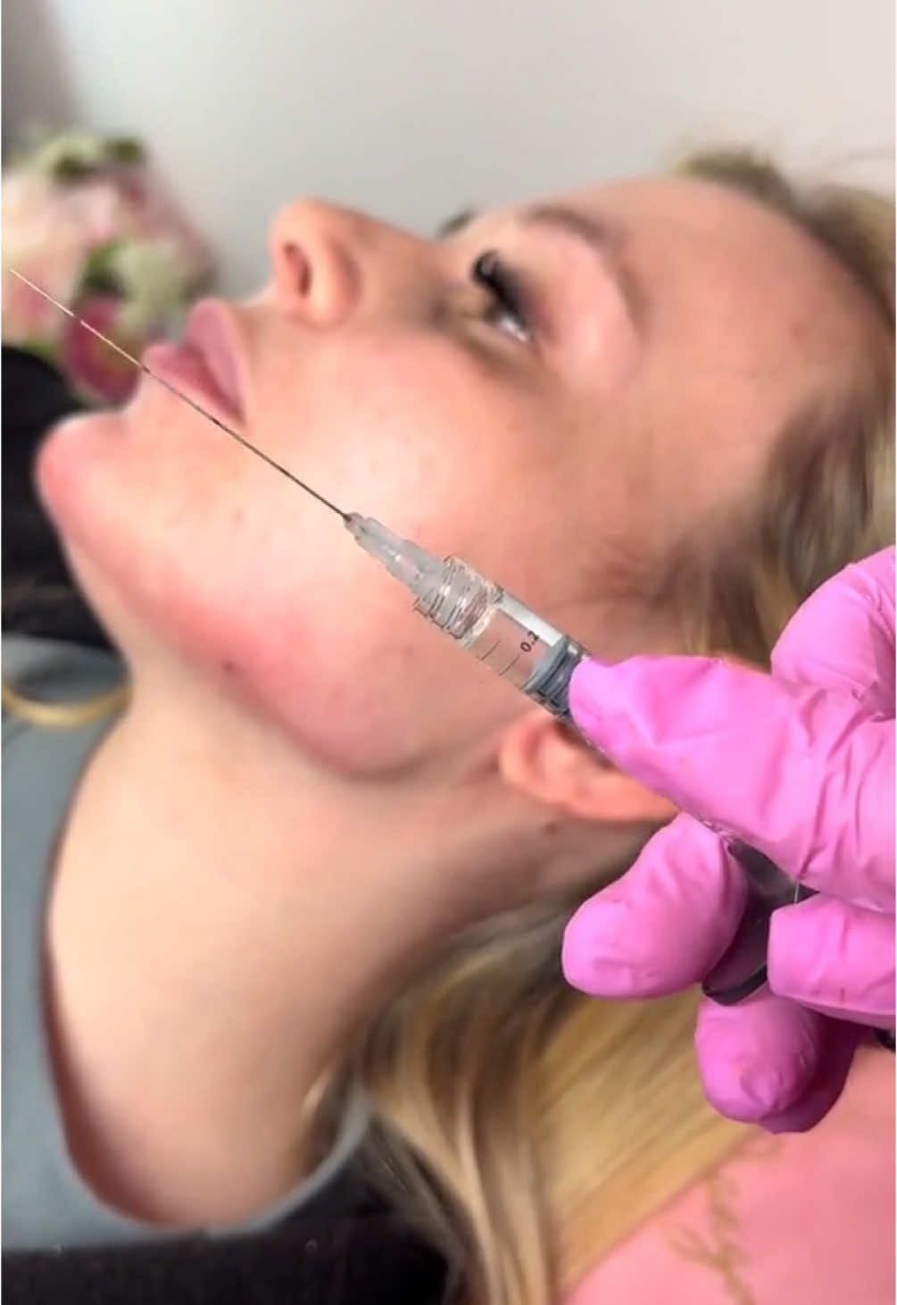Come watch me transform a jawline. 💉 #aesthetics #jawline #learnwithme #iconichooveringtechnique #aestheticspractitioner #jawlinefiller #snatched 