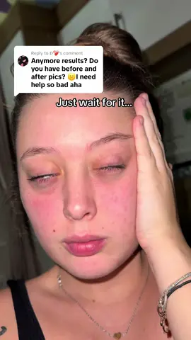 Replying to @𝐃❤️‍🩹 no huge suitcases for me, iykyk 🙌🏼 #undereyes #eyeserum #naturespell #bright #circles #brightundereyes 