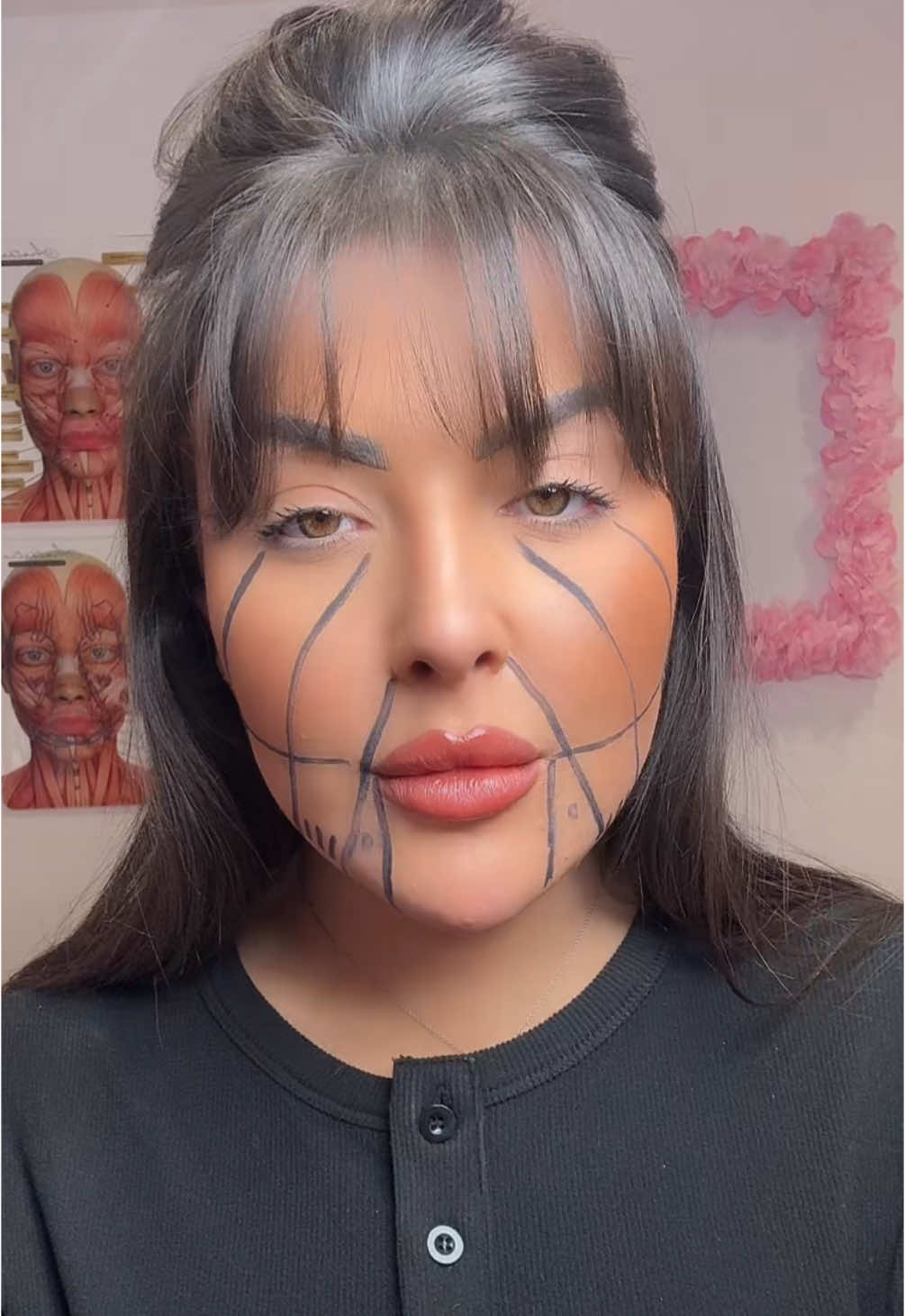 Come mark up masseter, jowls and DAOs with me for toxin!💉 #aesthetics #markup #markupwithme #toxin #antiwrinkle #lowerfacelift #aestheticspractitioner #aestheticseducation 