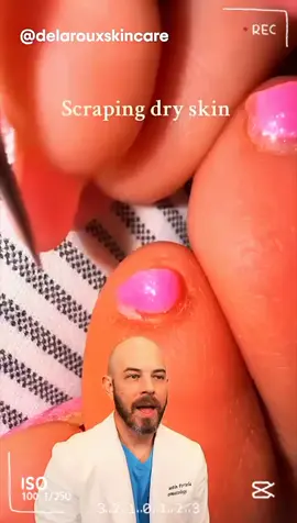 Did you know this cuticle fact- - #doctor #react #skincare #squeezeyuk #acne #pimple #pimplepop #blackhead #satisfying #foryoupage #foryou  #تنظيف_بشره  #whiteheads #رؤوس_سوداء #عنايه_بالبشره #دهون satisfying #trending #doctor 