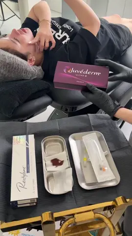 #𝗝𝗨𝗩𝗘𝗥𝗗𝗘𝗠 #𝗔𝗨𝗧 #𝗣𝗛𝗔́𝗣  ▫️Phải nói rằng ai đã sử dụng #Juverdem rồi thì mê lắm luôn vì độ gel tinh khiết , mềm mịn dã man . Tiêm M.O.I cứ phải gọi là đỉnh của chóp 🥰 #fillers💉 #lamdep #xuhuong 