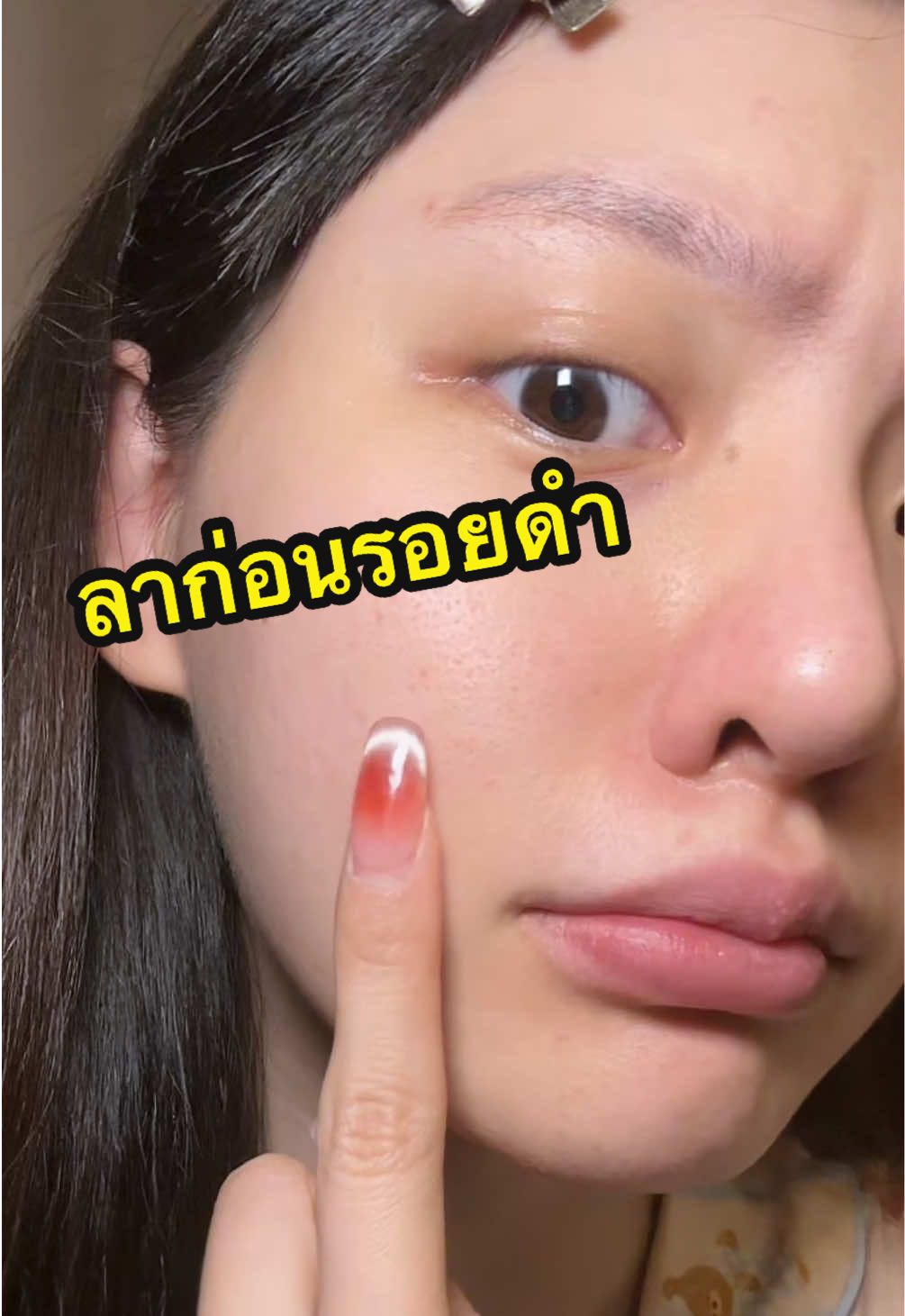 ขออวดตัวช่วยกู้ผิวโทรม เซรั่ม และ ครีมของ ลอรีอัล #เกมโอเวอร์จบทุกเกมจุดด่างดำ #GlycolicBrightMelasyl #LOrealParisTH #รีวิวสกินแคร์ #skincareroutine