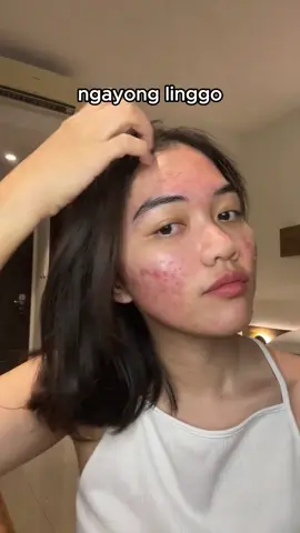 Hindi na kailangang tiisin ang abala ng mga taghiyawat! Ang aming acne cream ay malumanay na tinatanggal ang mga taghiyawat, nire-repair ang balat, at sa matagal na paggamit, mawawala ang mga taghiyawat at magbabalik ang kislap ng iyong balat! Walang kapintasan na balat, naghihintay na sayo!#Magpaalam sa acne#pangangalaga sa balat#cream ng acne