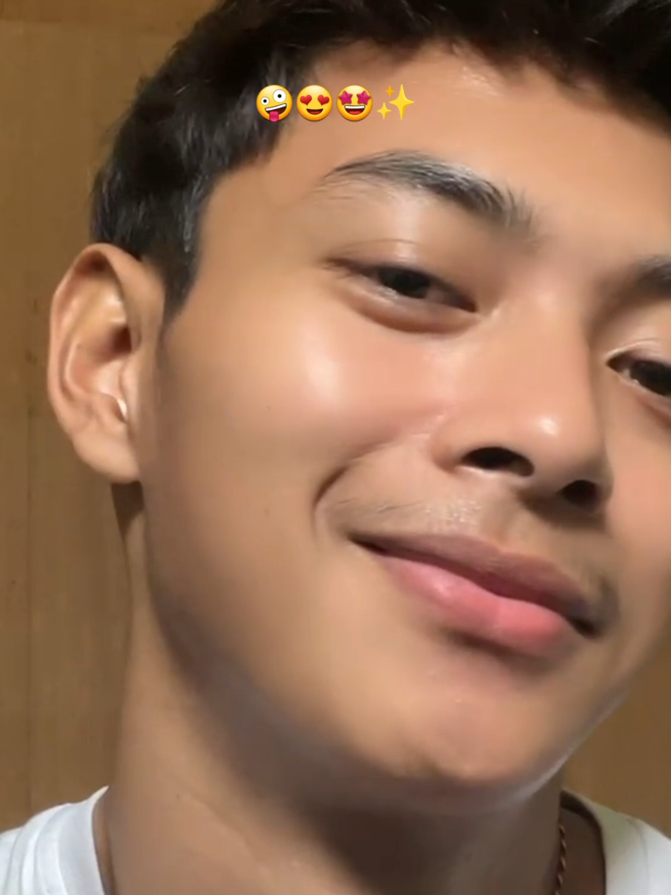 mau aku urus ga?, pake duo retinol skintific yah😚✨️