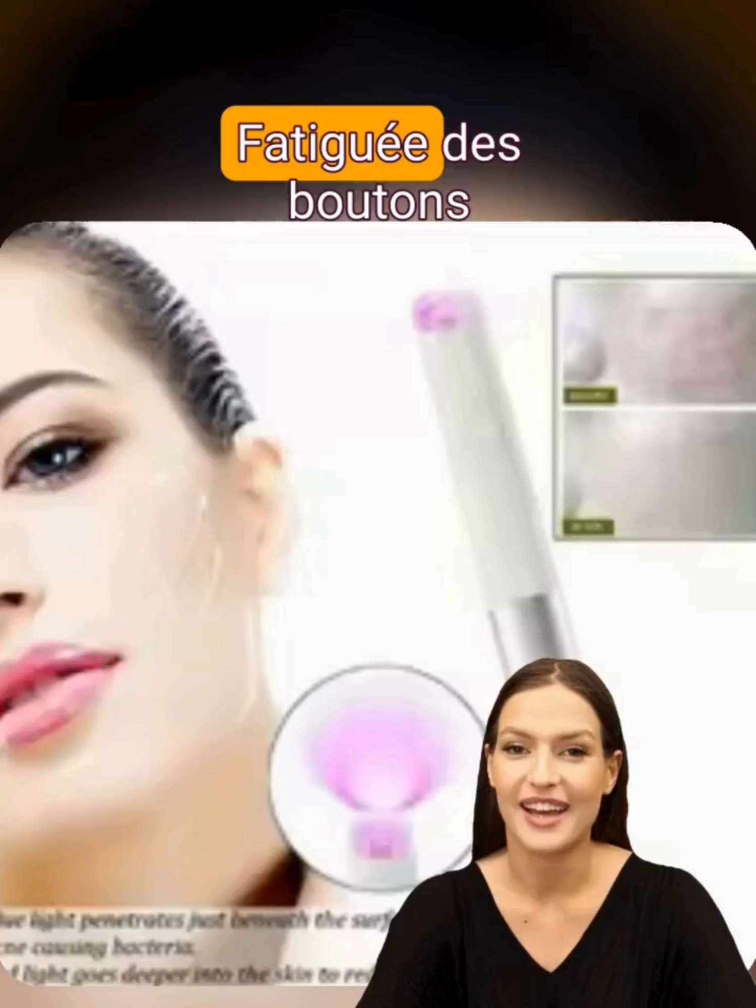 https://beauteradieuse.myshopify.com/products/stylo-de-luminotherapie-rouge-et-bleu?pr_prod_strat=e5_desc&pr_rec_id=d3caeeb6c&pr_rec_pid=9418062659849&pr_ref_pid=9418063544585&pr_seq=uniform #beaute #acne