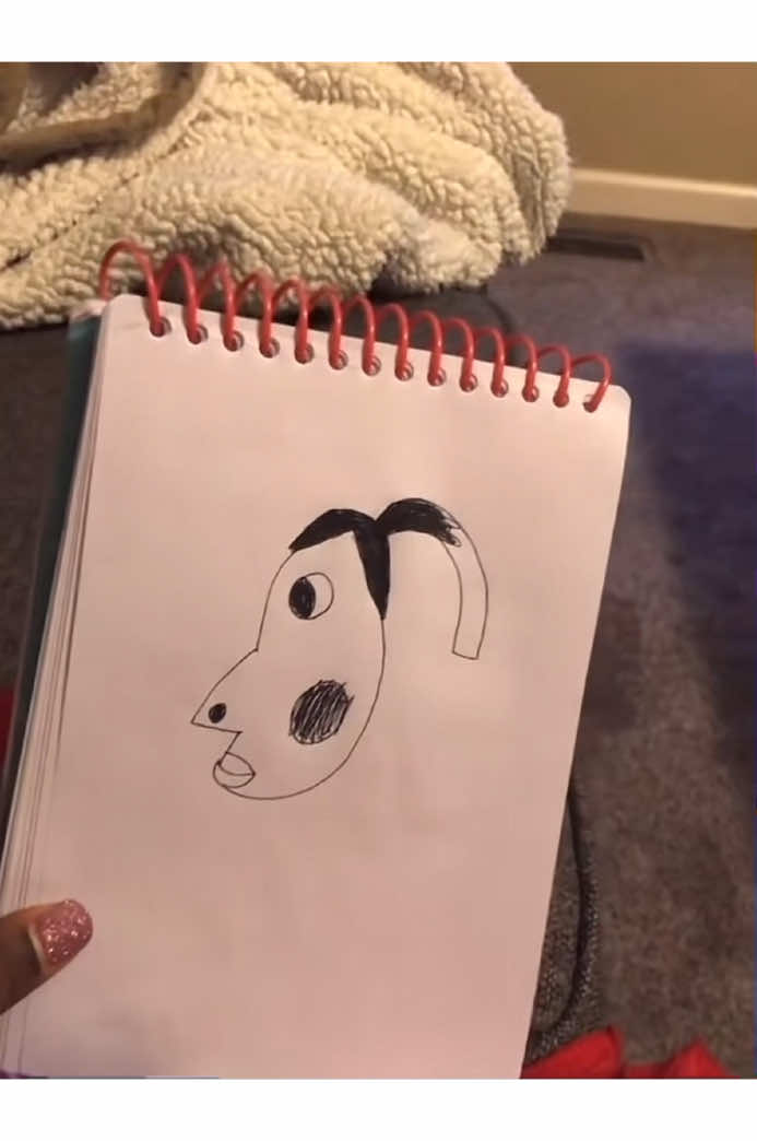 is that hyperpigmentation?? #viralvideos #hyperpigmentation #drawing #viral #foryou original post of the viral #meme 