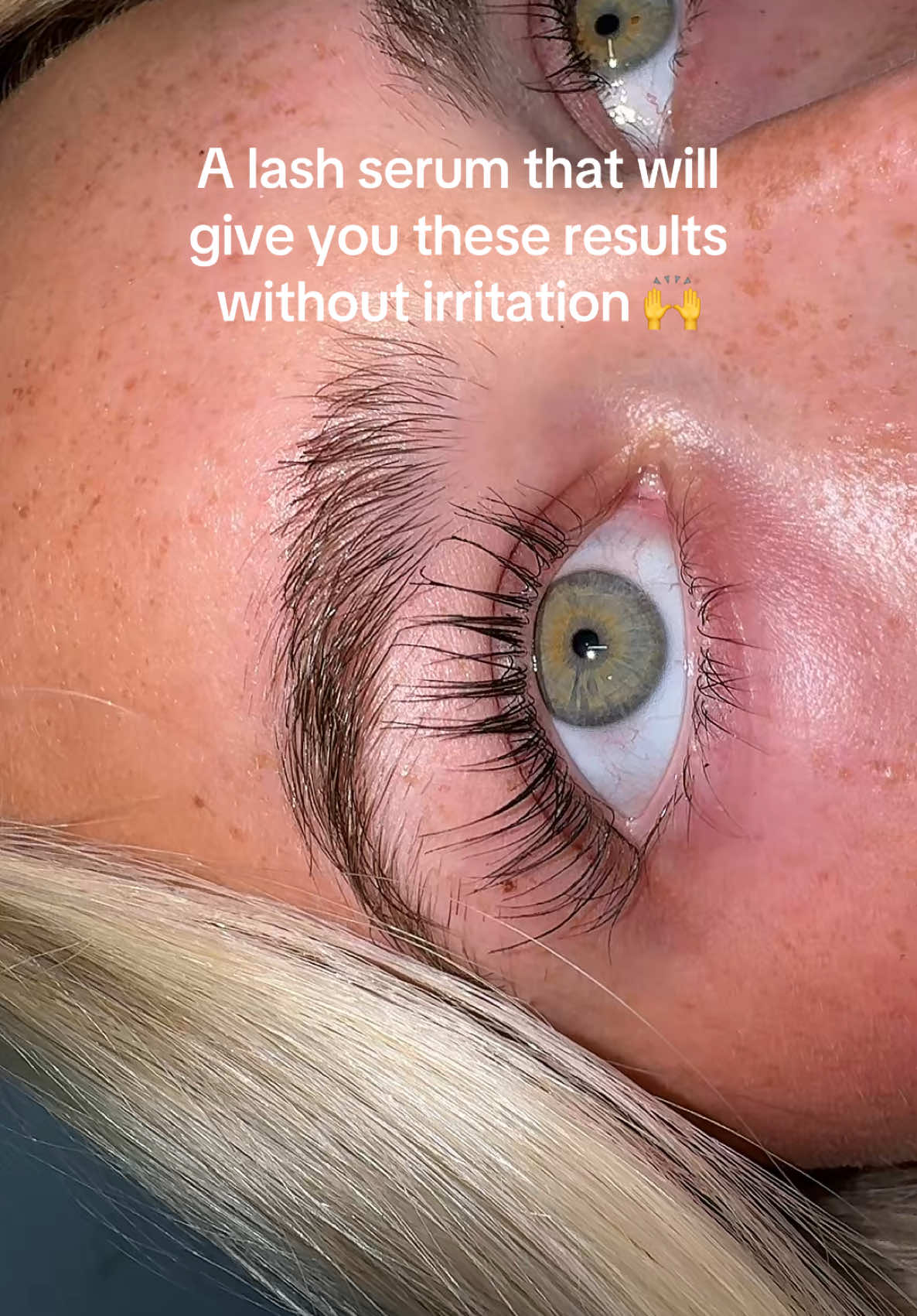 They are having their BIGGEST sale right now. Half off🤭 @nuorganic  #viral #viraltiktok #lashes #lashgrowth #lashserum #lashserumresults #lashserumupdate #musthaves 