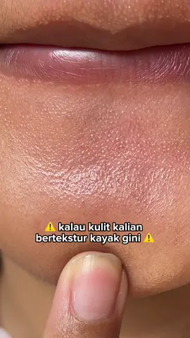 Inget ya guys eksfoliasi itu penting bgt kalo kalian mau kulitnya mulus dan halus!!💗✨ #peelingsolution #peelingserum #g2gpeelingsolution #eksfoliasi #skincare #skincaretips 