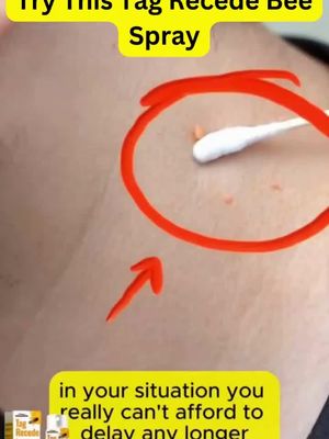 Say goodbye to warts with **Bee Spray For Wart**! Fast natural relief for smoother, healthier skin.
