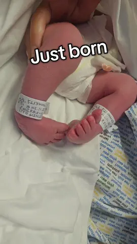 #babiesoftiktok #talipesbaby #talipes #clubfootjourney #talipesjourney #foryoupagе #ponsetimethod 