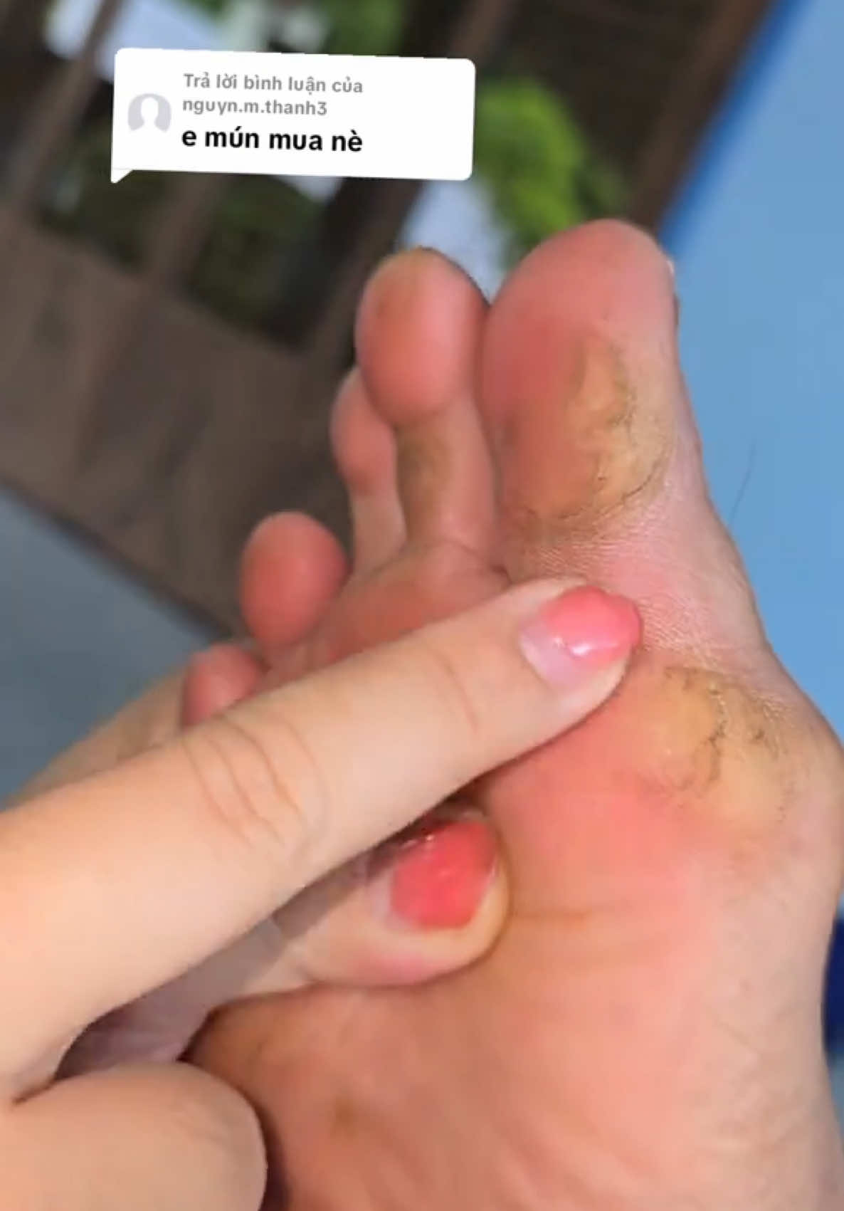 Dùng lăn gót chân này đúng là đỉnh luôn đó #nutnegotchan #Melaashopp #xuhuong  