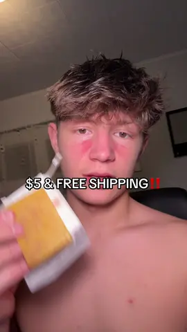 I loveeee this soap! Cant recommend it enough  #turmericsoap #turmericskincare #freeshipping 