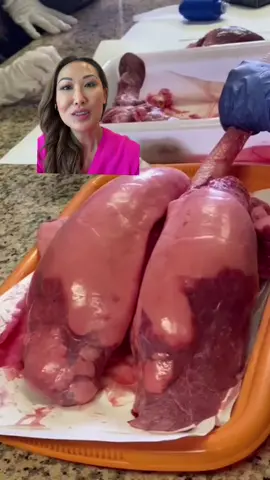 Anataomy lesson of the day #humanlungs #anatomy #medicalschool #greenscreenvideo 