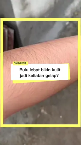 Bulu lebat bikin kulit jadi keliatan gelap? rontokan dengan skinuvia hair removal spray, sekali spray langsung rontok! #fyp #skinuviahairremoval #perontokbulu #resepglowing #skinuvia 