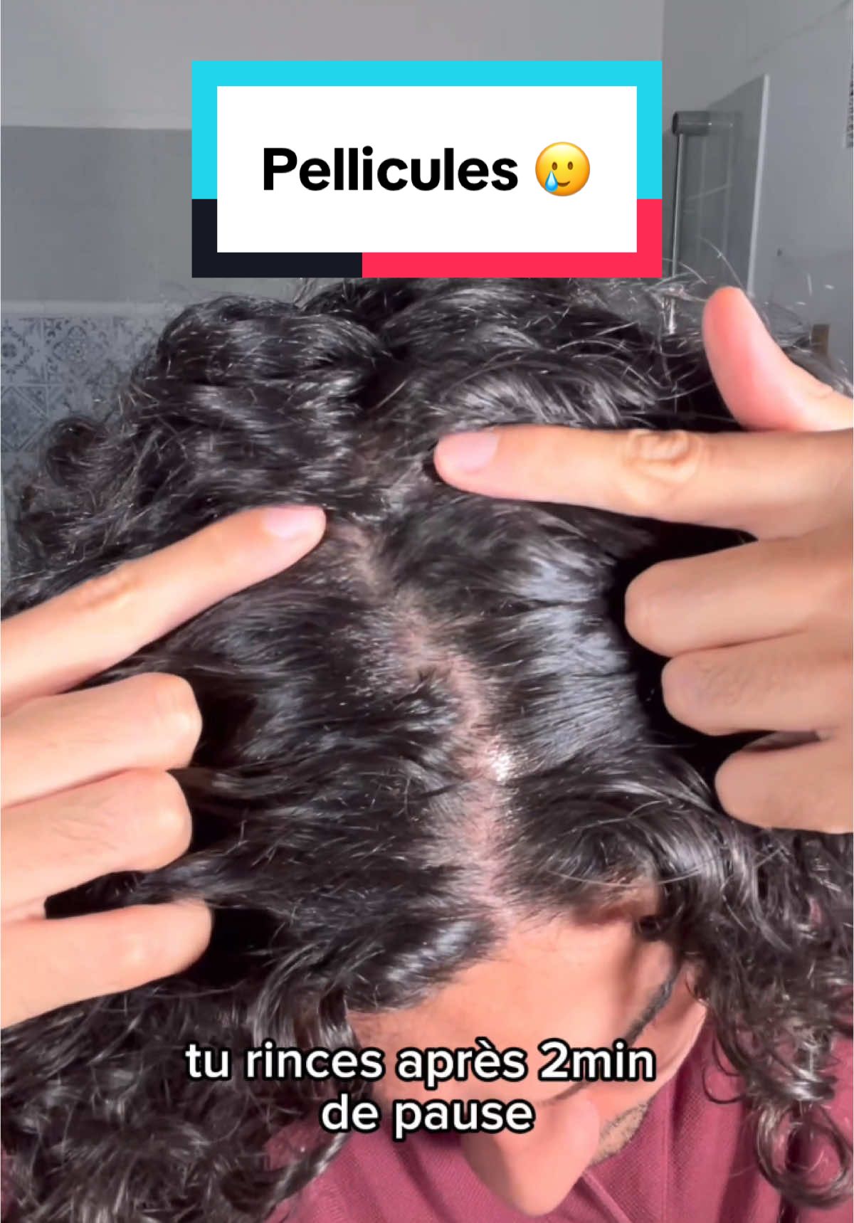 Un shampooing qui agit sur les pellicules? C’est @Vichy Laboratoires en pharmacie et parapharmacie. •2 actifs vont cibler ton cuir chevelu: l’acide Salicylique pour éliminer les cellules mortes et le Sélénium pour réduire la prolifération des champignons à l’origine de l’inflammation et des squames. •Pendant la phase d’attaque laissez poser 2min 3x par semaine pendant 1 mois puis pendant la phase d'entretien seulement 1 fois par semaine. Cela te permettra d’éviter les récidives. #Vichylaboratoires #Dercos #MevsDandruff #vichyhaircare #pellicules #Vichy #demangeaison #haircare #skincare #squame #grattage #soincheveux 