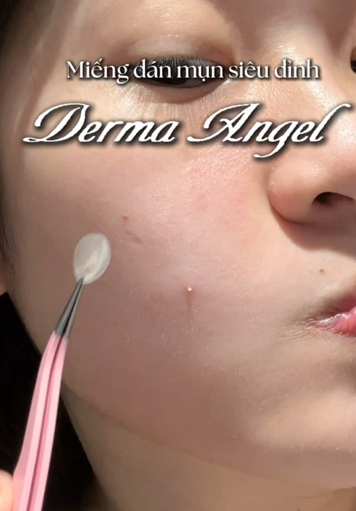 Nhớ xem cảnh tui lấy cái cồi ra nha, nó đã gì đâu á #nguyetbusine #3Brothersmedia #acnepatch #acnepatchplus #acnegel #dermaangel 