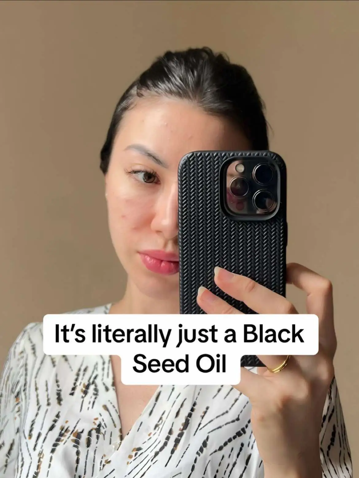 My beauty oil for night skincare. #viral #skincare #acne #hyperpigmentations #skintok #fyppppppppppppppppppppppp 