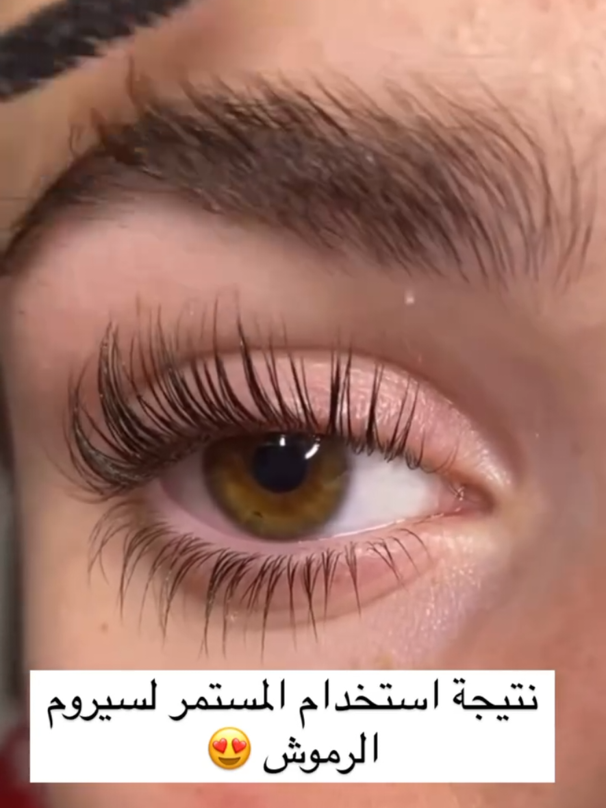 ‏Mavala السويسرية🇨🇭  ✨ مافالا للرموش والحواجب   افضل سيروم لتقوية وتكثيف الرموش والحاجب توفر 😚 #سيروم تطويل الرموش 🔥 #MAVALA #Doublelash 💥 صنع سويسري 🇨🇭جودة عالية 100٪ تستحق ثقتك 😍 سيروم مافالا الفعال 100% في زيادة طول الرموش وحمايتها من التساقط بدون استعمال رموش إصطناعية♥️. ✅ مكثف ومغذي ومقوي في نفس الوقت❤️. ✅ ينصح به من قبل اطباء العيون💯💯 ✅ يمكن إستعماله للرموش و الحواجب  ✅ يحفز نمو الرموش والحاجب حيث يضمن زيادة الطـــول والكــثــافــة والسّـــمــك 😍 ✅ سيروم مغذي يجمع ما بين مطول للرموش و مقوي للرموش وأيضاً مكثف للرموش👁 ✅ يحتوي على مواد طبيعية غنية بالفيتامينات والبروتينات حيث تعمل على تقوية وحماية رموشك وحواجبك  ✅ غنية بحمض الجليكوليك الذي يساعد بنمو الشعر وتقليل تساقطه بالاضافة الى انها خالية من الزيوت  المعدنية والبارابين والعطور والمواد الضارة.. ✅ لايسبب تهيج للبشرة الحساسة التي حول العين الاصلي💯المنشأ سويسرا🇨🇭 السعروالحجز خاص  🚘يوجد خدمة توصيل لجميع محافضات العراق ٤ الاف 🚘