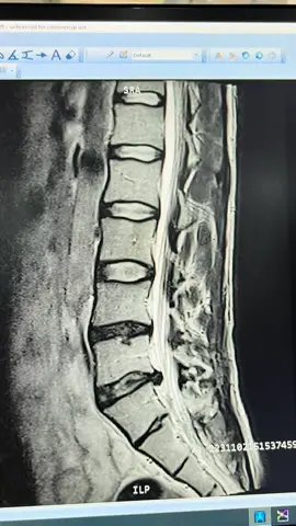 #mahmoud_aboras #fypシ #bestforhealth #fitnessgoals #Fitness #healthtips #weightloss #workout #gym #EduTok #homeremedies #acupressure #healthiswealth #stayhealthywithdrcarla