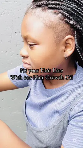 Fix Your Hairline with Glory Nourish Hair Growth Oil! Say goodbye to thinning edges and hello to a healthy, full hairline! Our Glory Nourish Hair Growth Oil is here to help. To see results, remember to: Apply the oil at least twice a day (morning and night) Be consistent with your application Avoid tight hairstyles that can cause hair loss By following these simple steps, you'll be on your way to a healthier, fuller hairline! Get your Glory Nourish Hair Growth Oil today @Edenvinne stores (Menlyn Mall & Randburg Square) or shop online with nationwide delivery through Paxi and Aramex. #GloryNourish #HairGrowth #HairlineFix #HairNourishment #naturalhairproductssouthafrica #glorynourishproducts #tiktoksouthafrica🇿🇦 #hairproductssouthafrica #hairlinegrowth #fyp 