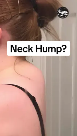 Did you know that neck humps, also known as buffalo humps, are often caused by poor posture, prolonged sitting, or even stress? Over time, slouching can lead to a buildup of fatty tissue and muscle imbalances in the upper back. Here are 3 simple tips to help reduce your neck hump. Questions? Ask below! #neckhump #buffalohump #posture #neckpain #neckpainrelief #backpain #backpainrelief #papachiropractic #chiropractor #drpapa #chiropractic 