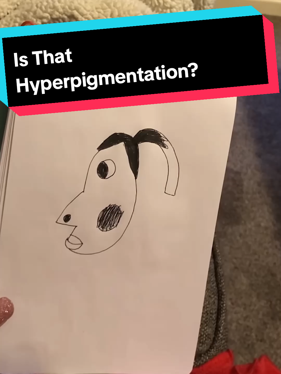 This poor girl's drawing became a viral meme... #memes #memesexplained #hyperpigmentation #hyperpigmentationmeme #isthathyperpigmentation #hyperpigmentationdrawing #viral #trending #tiktokmemes #viralvideo 
