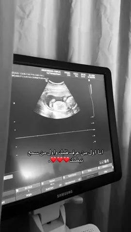 🥹.#بيبي👼🏻💙 #اكسبلور #fyp 