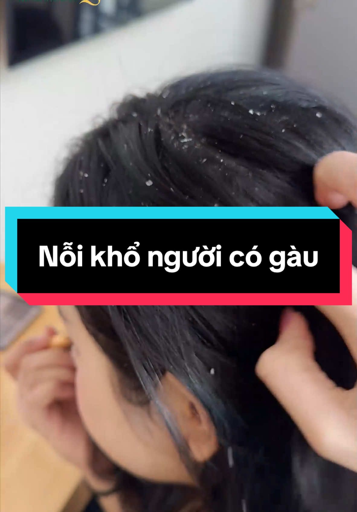 Nỗi khổ người có gàu #xuhuong #rungtoc #daugoi #daugoithaoduoc #daugoinamnung 