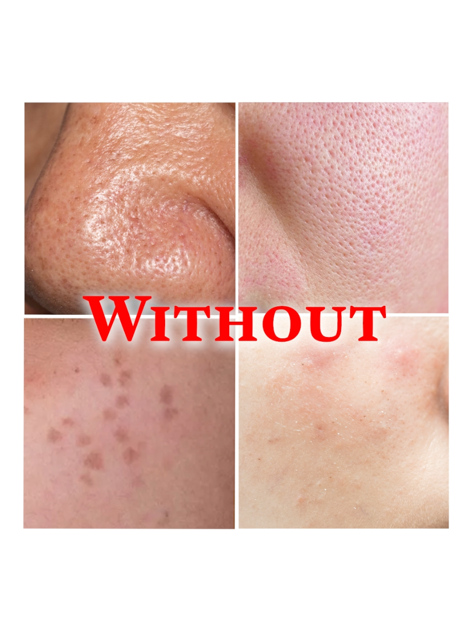 Your skin deserves love, too! 💕 Why skincare isn’t just a luxury—it’s self-care. 🧖‍♀️✨ #foryourpage #koreanskincare #blackheadremovals  #KBeautyProducts #SkincareForClearSkin #SkincareForEverySkinType #skincaretipsforyou  #SkincareTipsAndTricks