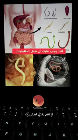 #parasite #parasitecleanse #gut #worms 