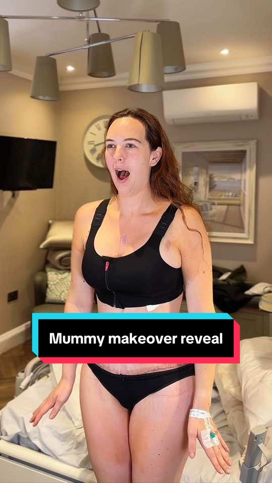 Megan recently had a Tummy Tuck (Abdominoplasty) with Breast uplift surgery (together a Mummy Makeover) with the talented @Rado after seeking improvements in her abdominal area and breasts.  Megan faced challenges that many mothers know too well: (Diastasis recti), loose overhanging skin, stretch marks, and sagging breasts after giving birth to her beautiful children. She decided to undergo surgery to enhance her self-esteem, improve her overall appearance, and feel more confident in herself and the clothes she wears.  You can see from the video she achieved just that 😍  At this stage of the healing process, visible swelling and bruising are completely expected. Despite that, you can see just how much this surgery means to Megan! ✨ We are so happy to see the joy this transformation has brought her, and we can’t wait to follow her journey as her results continue to progress. ❤️    #bellavou #tummytuck #tummytucksurgery #mummymakeover #tummytuckjourney #tummytucklondon #plasticsurgeon #plasticsurgery #plasticsurgerylondon #cosmeticsurgery #cosmeticsurgerylondon #abdominoplastia #abdominoplasty