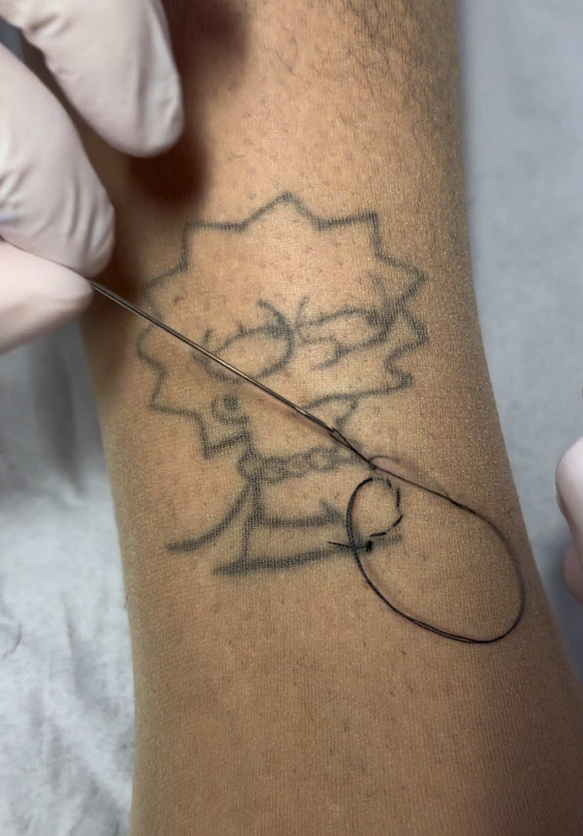 Agora a NASA vem!!! 🪡🧵🔥 Reforma com costura na pele 😍 #tatuagem #bordado #viral_video #patchtattoo #embroiderytattoo #tatuagemcosturada #simpsons #thesimpsons 