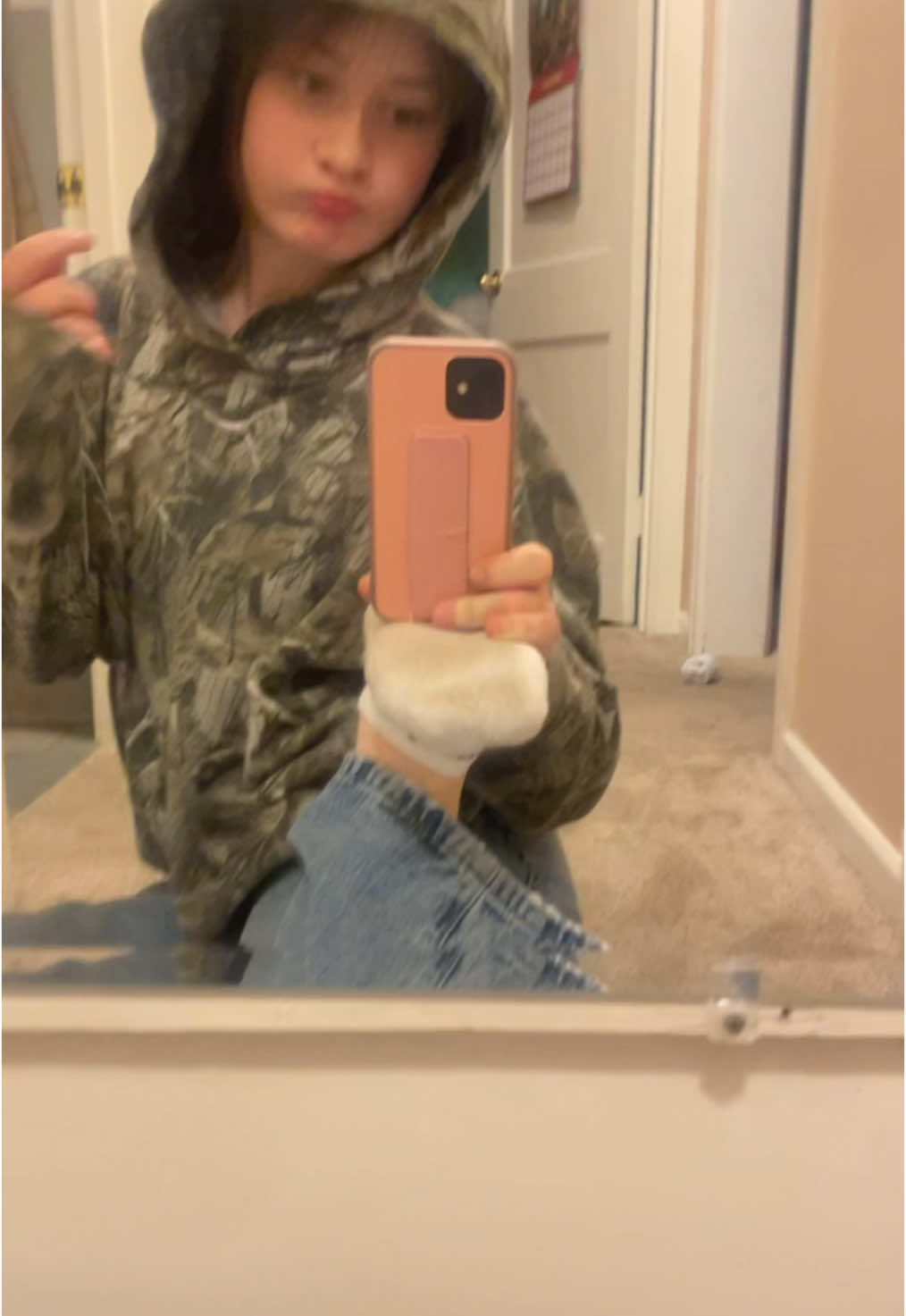 do i win? #hyperflexible #doublejointed #birthdefect #dislocatedhips #iibtpuiygtom #yesthatisthebottomofmyfoot