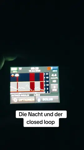 Die Nacht und der closed loop. Es ist kompliziert. #fyp #diabetesawareness #diasafespace #t1d #diabetes  #chronicillness #insulinpumpe #insulin #dedocde #dedoc #pumpe #cgm #dexcomG7 #dexcom #vitalaire #tslim #blutzucker #loop #tandem #closedLoop #Nacht #SleepModus #SleepMode 