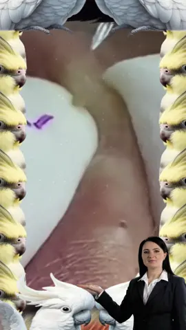 é gratificante assistir e é hora de dormir😴💤#blackhead #granos #pimple #espinhas #satisfy #fyp