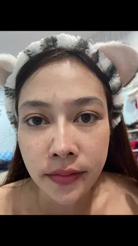 ✨เจอแล้ววว โฟมลดสิว ✨#รีวิวบิวตี้ #โฟมล้างหน้า #ใช้จริงรีวิวจริง 