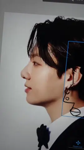 #hyperpigmentation #fypp #jungkook #jungkookie #hyperpigmentationtreatment #jungkookjeon #jeonjungkook #foryou #fyp #foryoupage #kesfet #jk #jungkookbts #fypp 